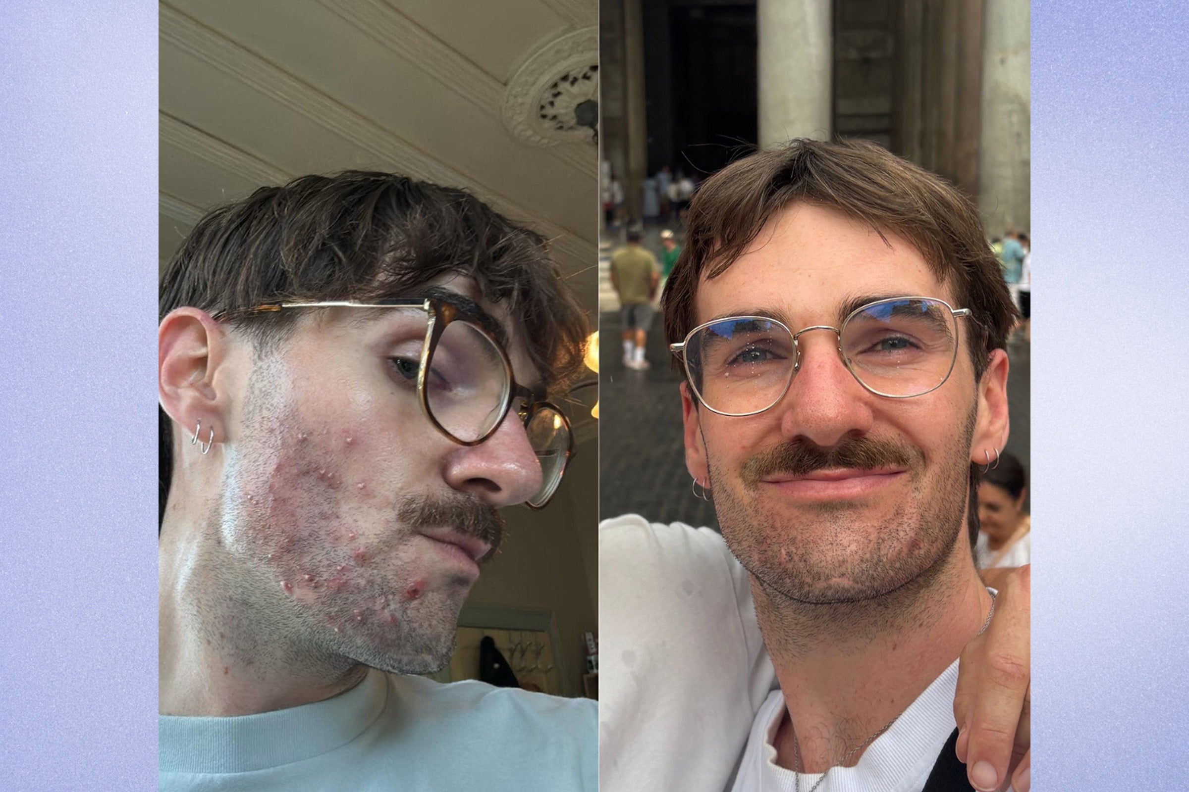 The BePure Community Spotlight: Rafe’s Story